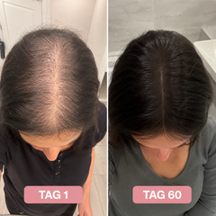 HAERU™ Root Renewal Comb