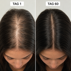 HAERU™ Root Renewal Comb